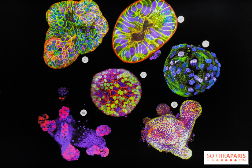 Cancers cité des sciences et de l'industrie