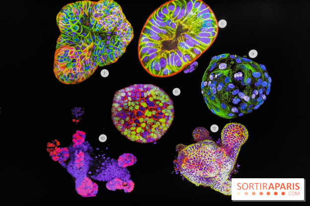 Cancers cité des sciences et de l'industrie