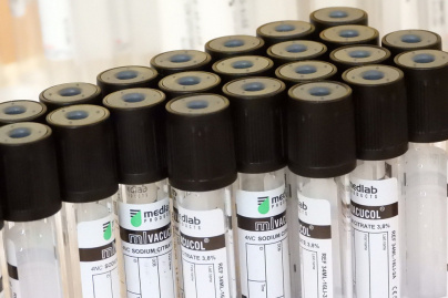 Coronavirus : un test pour mesurer le degré d'immunité ?