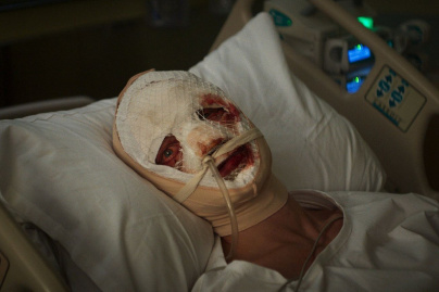 Clayface : Tom Rhys Harries