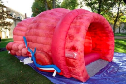 Movember 2018 : explorez une prostate géante à la Clinique Lambert à La Garenne-Colombes