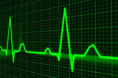 La mortalité a augmenté de 9% en 2020, d'après le bilan provisoire de l'Insee