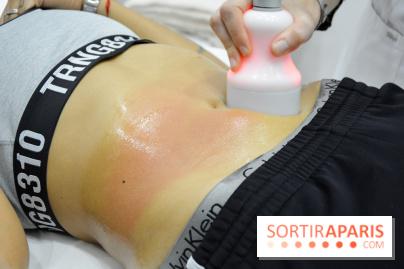 Soin Cryolipolyse chez Cryobar