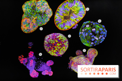 Cancers cité des sciences et de l'industrie