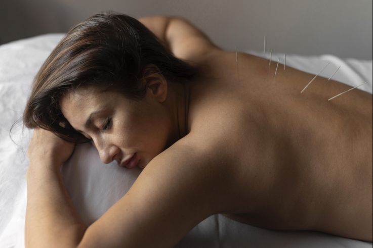 Salon Bien-Être Médecine Douce Paris 2026 - medium shot woman acupuncture