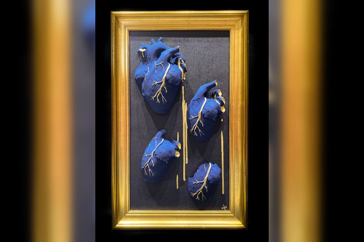 Écorchée Vive : l'exposition choc sur la féminité et le corps à la Galerie La Lison