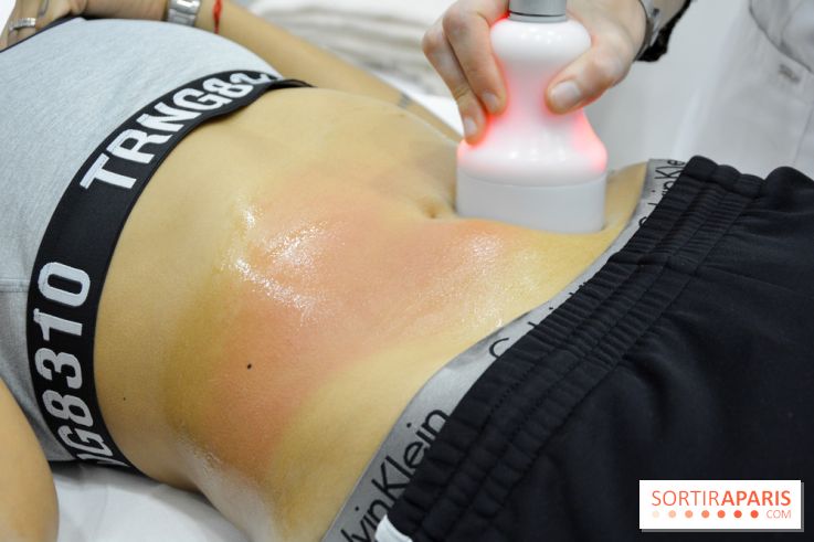 Soin Cryolipolyse chez Cryobar