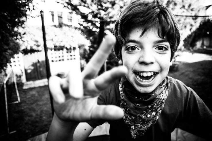 Être beau, l'exposition photo autour du handicap au Musée de l'Homme