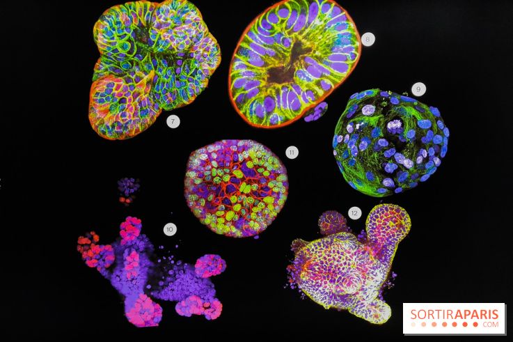 Cancers cité des sciences et de l'industrie