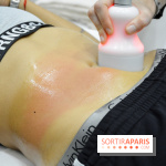 Soin Cryolipolyse chez Cryobar