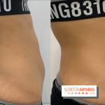 Soin Cryolipolyse chez Cryobar