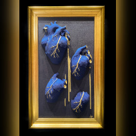 Écorchée Vive : l'exposition choc sur la féminité et le corps à la Galerie La Lison