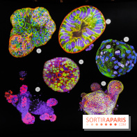 Cancers cité des sciences et de l'industrie