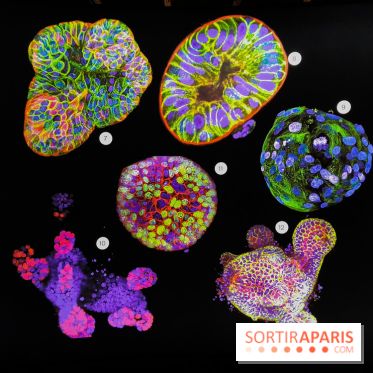 Cancers cité des sciences et de l'industrie