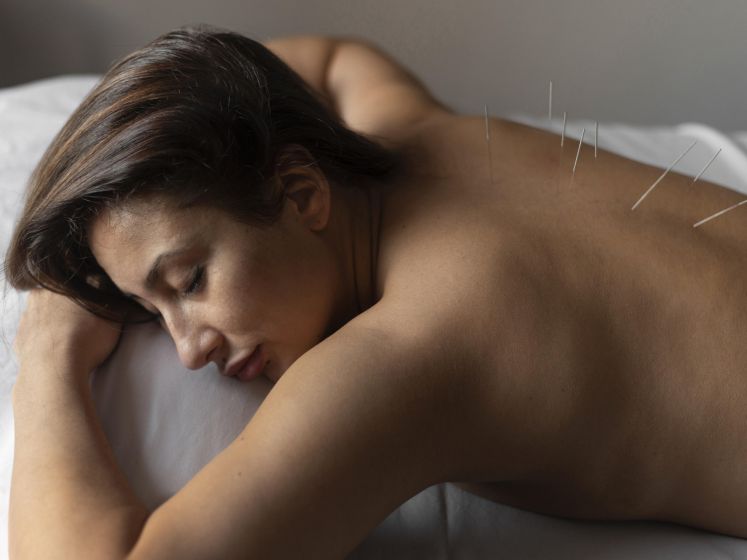 Salon Bien-Être Médecine Douce Paris 2026 - medium shot woman acupuncture