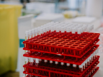 Vaccin Covid : la France devrait donner 500 000 doses d'AstraZeneca à des pays d'Afrique d'ici juin