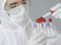 Variole du singe : comment se transmet-elle, quels sont les symptômes ?