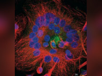 "Portrait(s) de cellules" au Musée Curie