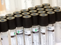 Coronavirus : un test pour mesurer le degré d'immunité ?