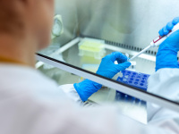 Coronavirus : des tests salivaires pour faciliter le dépistage ? 