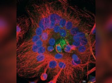 "Portrait(s) de cellules" au Musée Curie