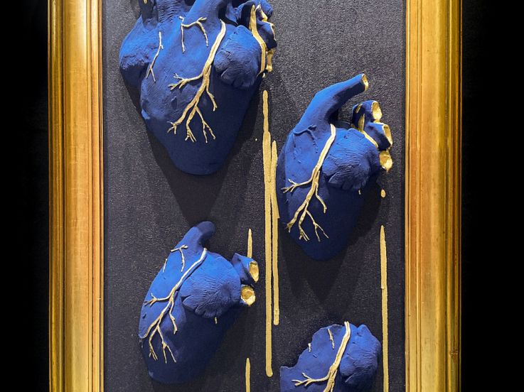 Écorchée Vive : l'exposition choc sur la féminité et le corps à la Galerie La Lison