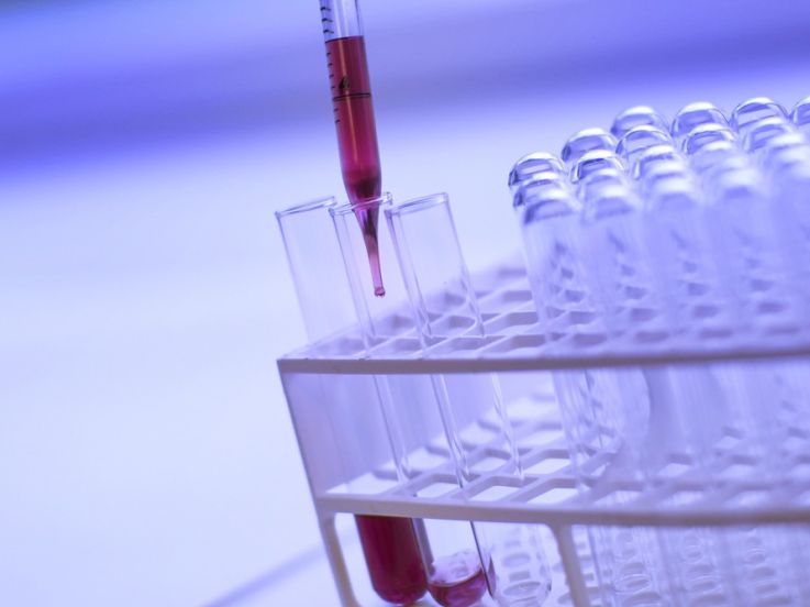 Coronavirus : le tarif des tests antigéniques désormais fixé pour les professionnels de santé