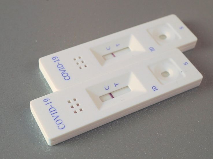 Covid : un test sérologique peu couteux mis au point par un chercheur toulousain