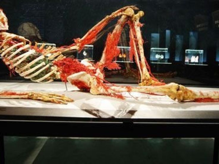 Exposition, Our body, A corps ouvert, Interdiction