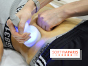 Soin Cryolipolyse chez Cryobar