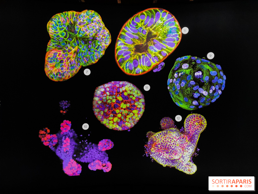 Cancers cité des sciences et de l'industrie