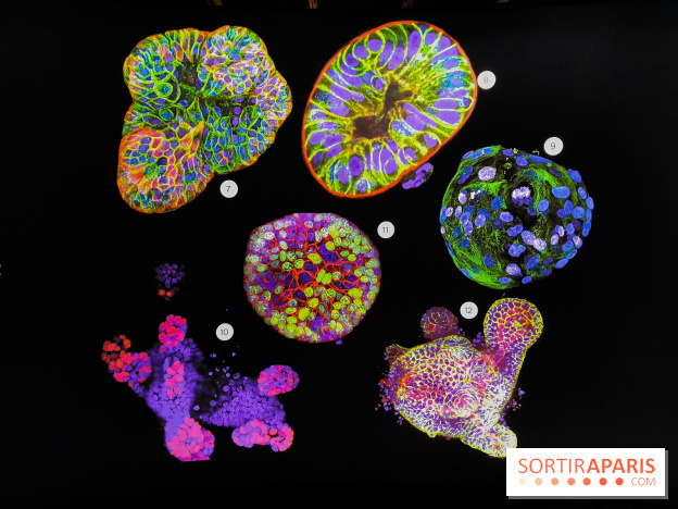 Cancers cité des sciences et de l'industrie