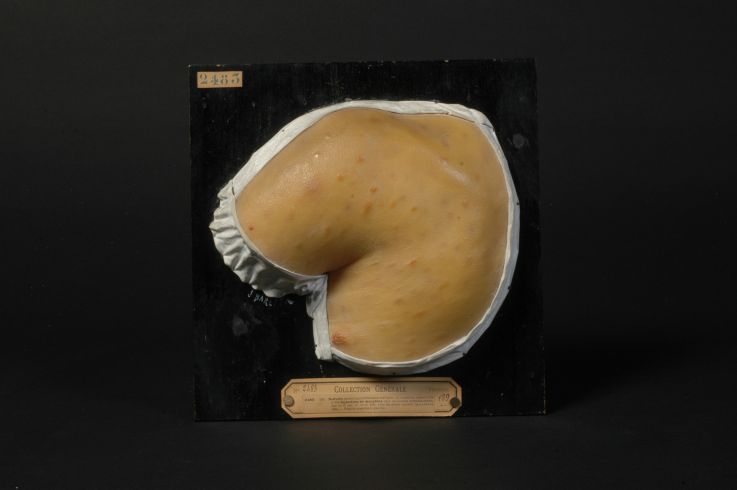 Paris insolite : l'incroyable Musée des Moulages de l'hôpital Saint-Louis