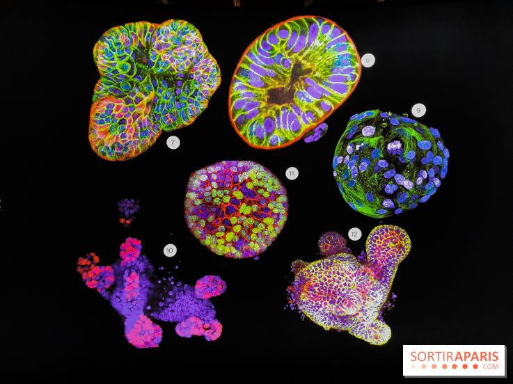 Cancers cité des sciences et de l'industrie