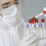 Variole du singe : comment se transmet-elle, quels sont les symptômes ?