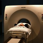 Coronavirus : des symptômes neurologiques ?