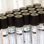 Coronavirus : un test pour mesurer le degré d'immunité ?